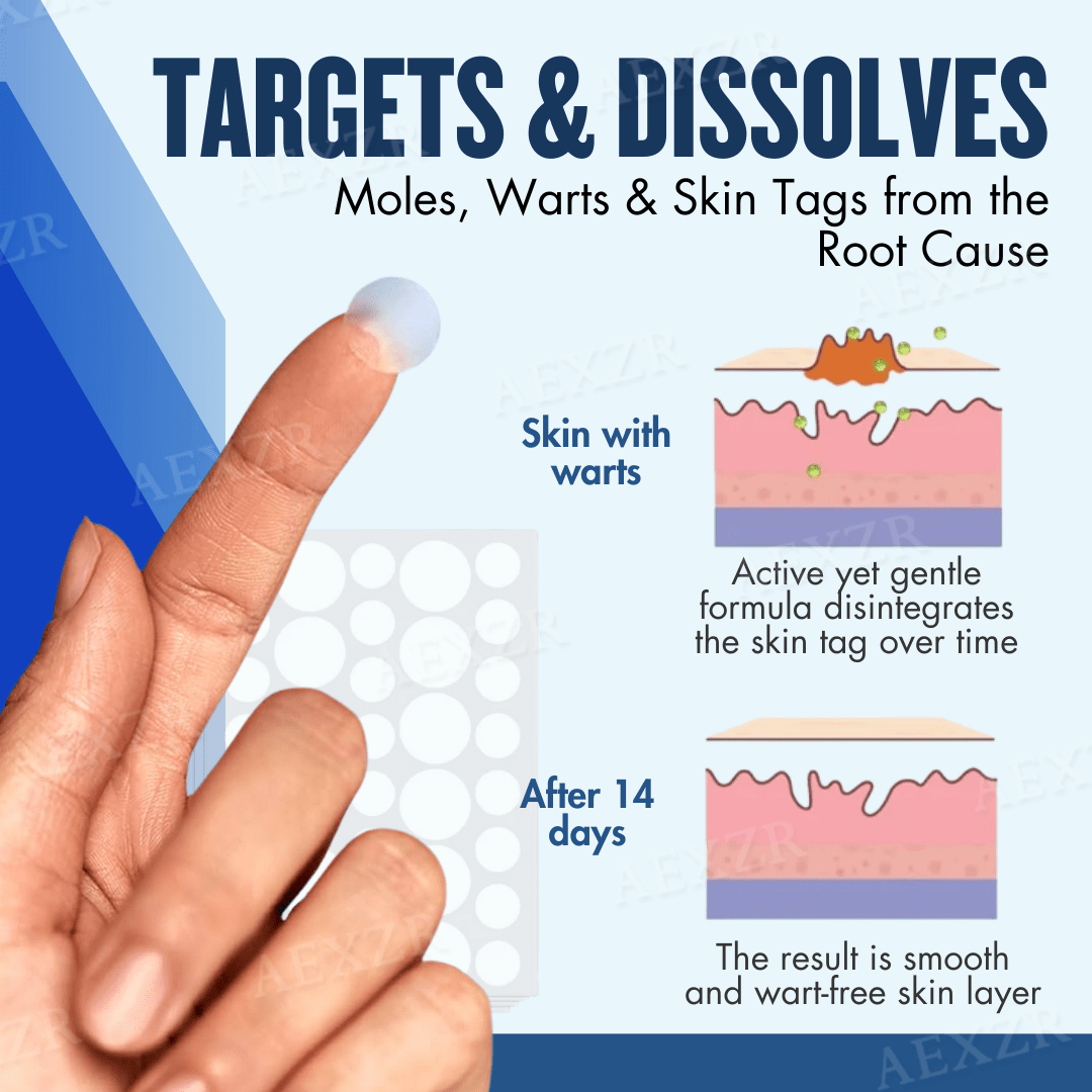 ClearSkin™ | Retrouver confiance et beauté