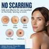 ClearSkin™ | Retrouver confiance et beauté