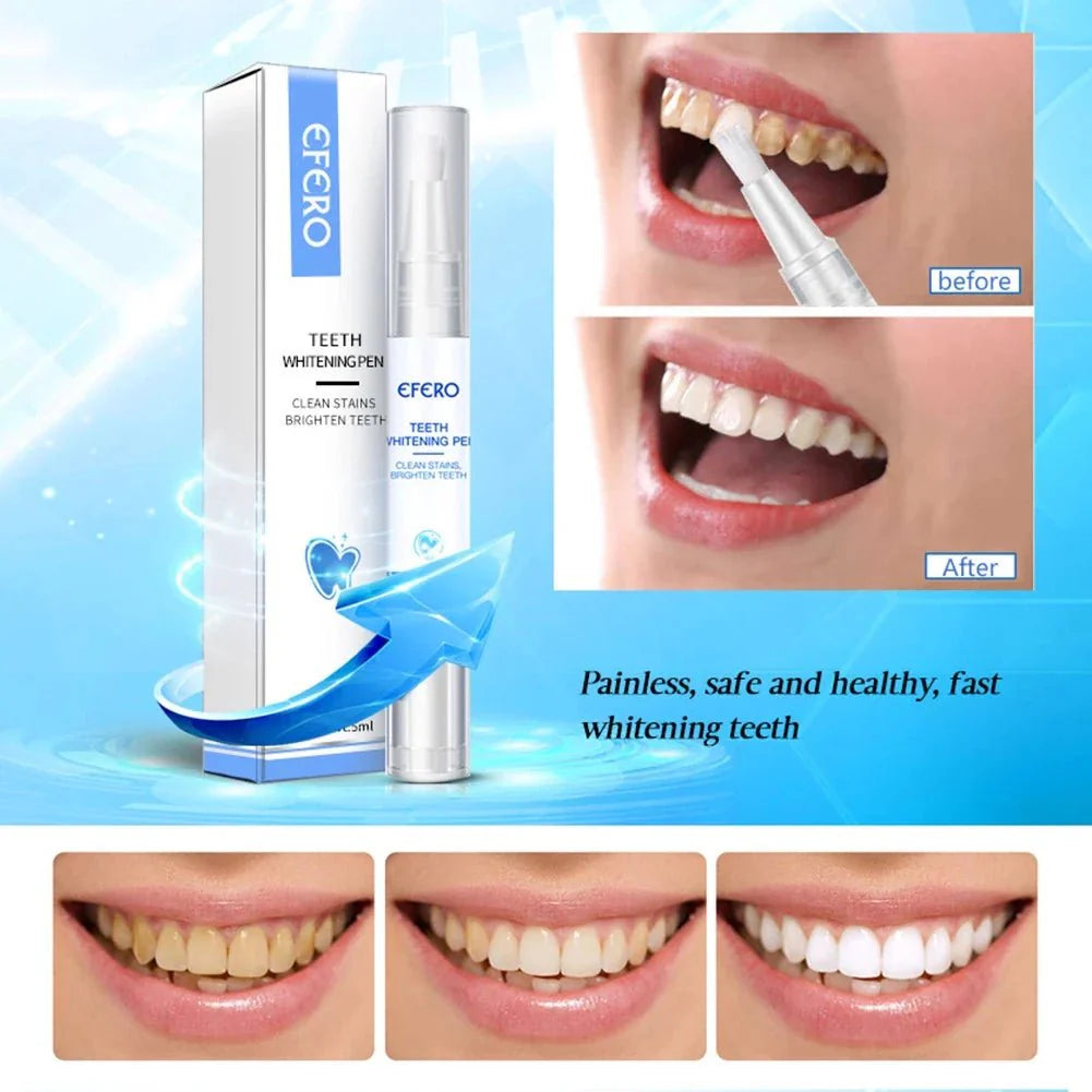 ÉclatDents™ | Sourire éclatant instantané