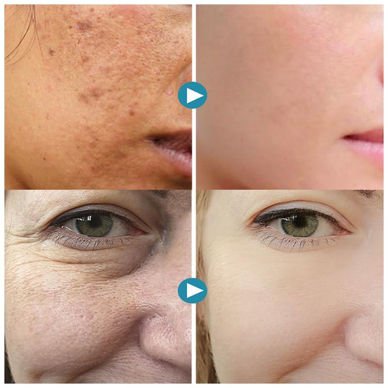 SilkPores™ | Peau lisse et radieuse