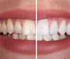 SmileKit™ | Vous vous sentez plus confiant avec un sourire frais et radieux qui dure