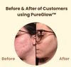 PureGlow™ | Éclat naturel et confiance retrouvée