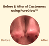 PureGlow™ | Éclat naturel et confiance retrouvée