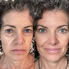 EyeRevive™ | Éclat et fraîcheur retrouvés