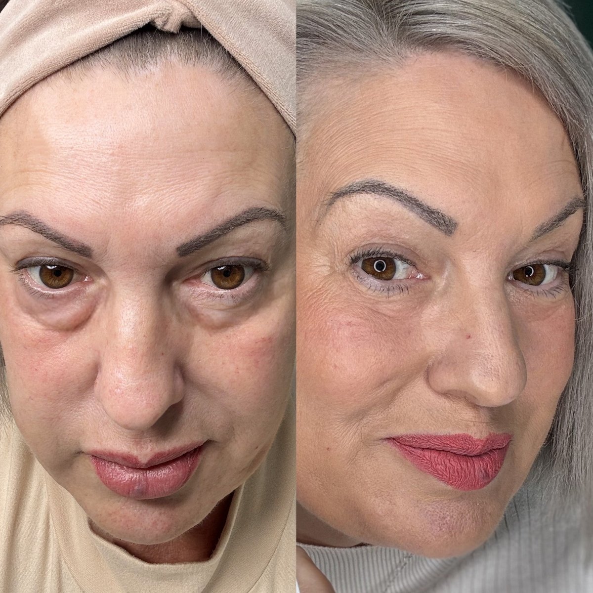 EyeRevive™ | Éclat et fraîcheur retrouvés