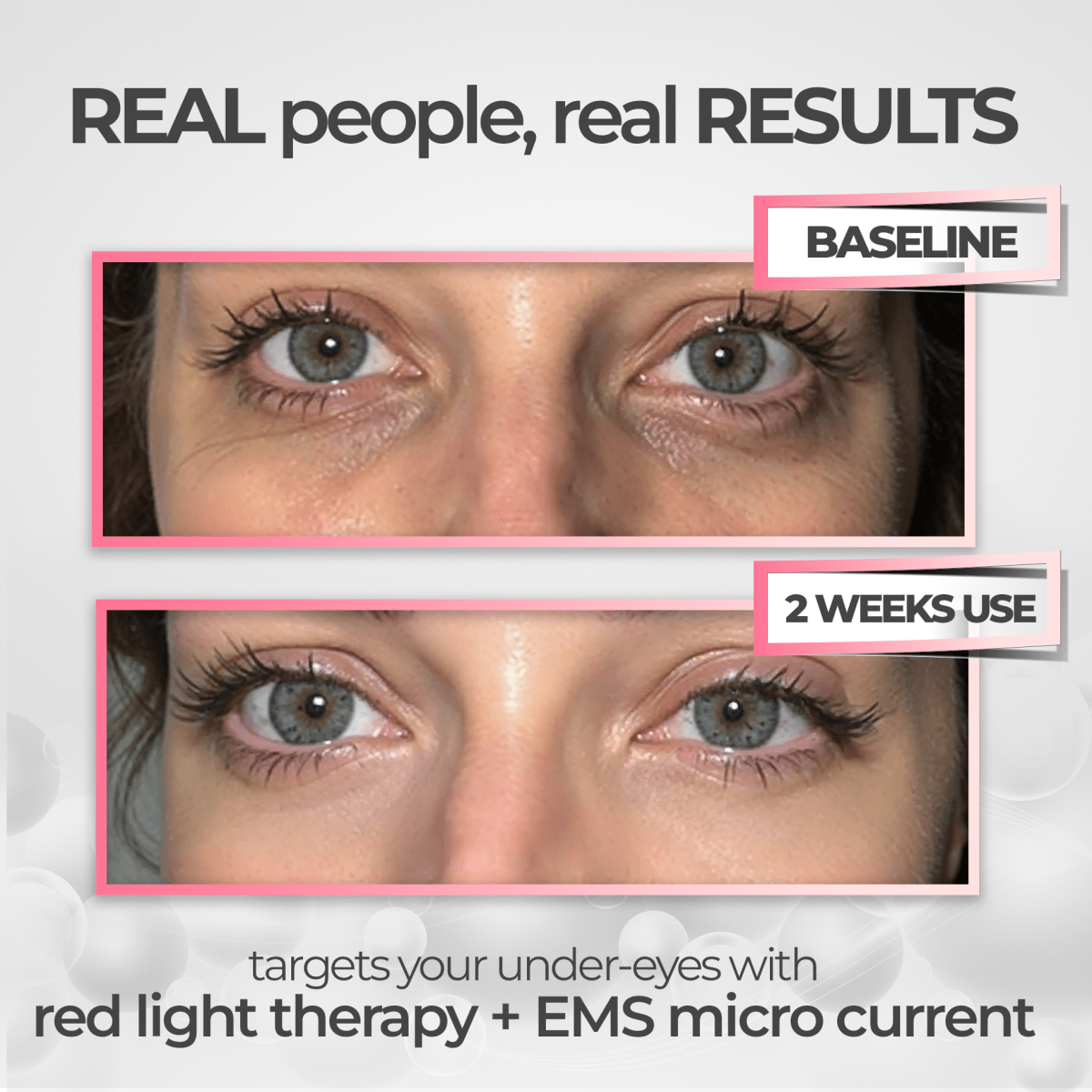 EyeRevive™ | Éclat et fraîcheur retrouvés