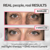 EyeRevive™ | Éclat et fraîcheur retrouvés